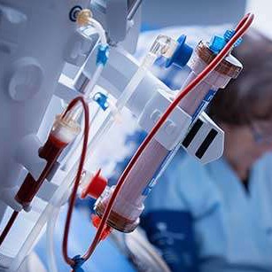 Гемодиализ 