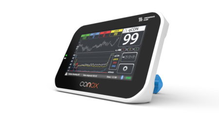 Conox 